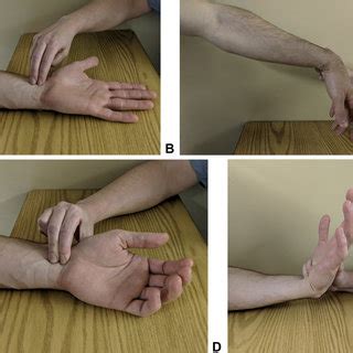 augmented durkan compression test|tinel test vs phalen.